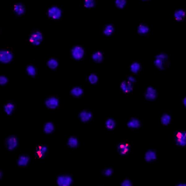 Fluorescent microscope image of Drosophila Kc167 cells treated with PR-Set7 RNAi and labeled with DSHB antibody UNC93-5.2.1 (red). PMID: 27131378, Fig. 3A.